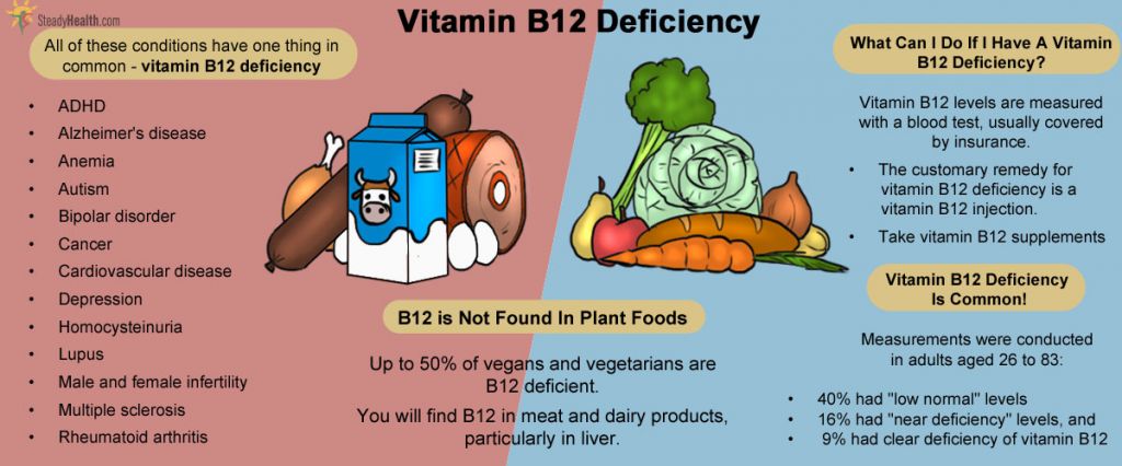  Vitamin B12 Deficiency