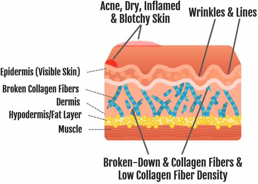 Low Organic Sulfur Can Lead To Common Skin Issues