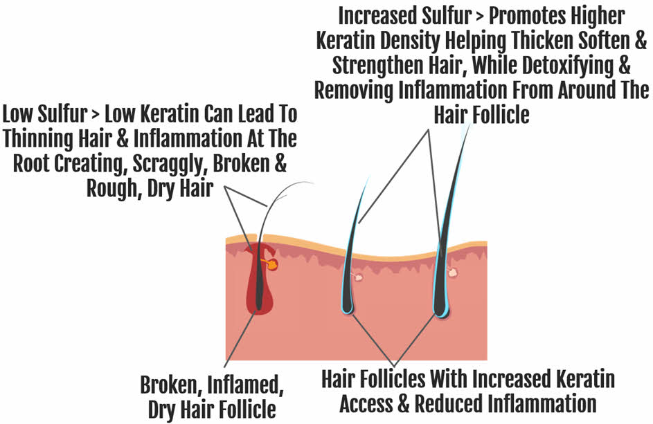 Increased Sulfur supports optimal skin health